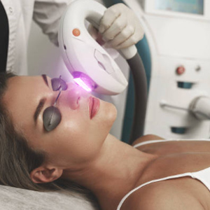 IPL skin rejuvenation