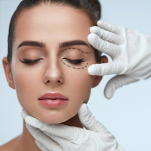 blepharoplasty